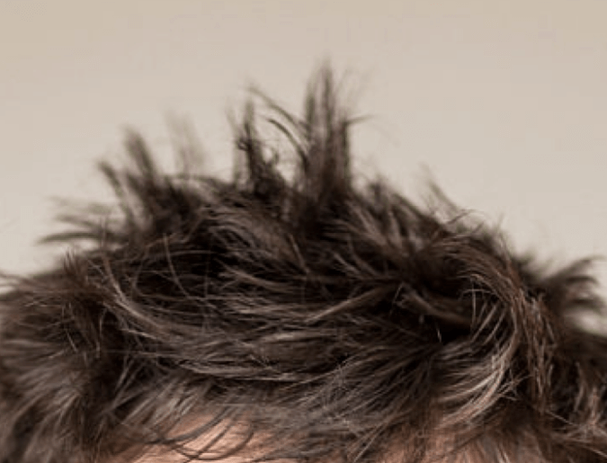 Cheveux ébouriffés Cheveux ébouriffés