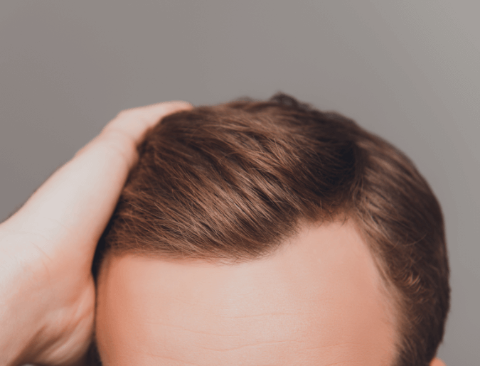 Cheveux homme Cheveux homme